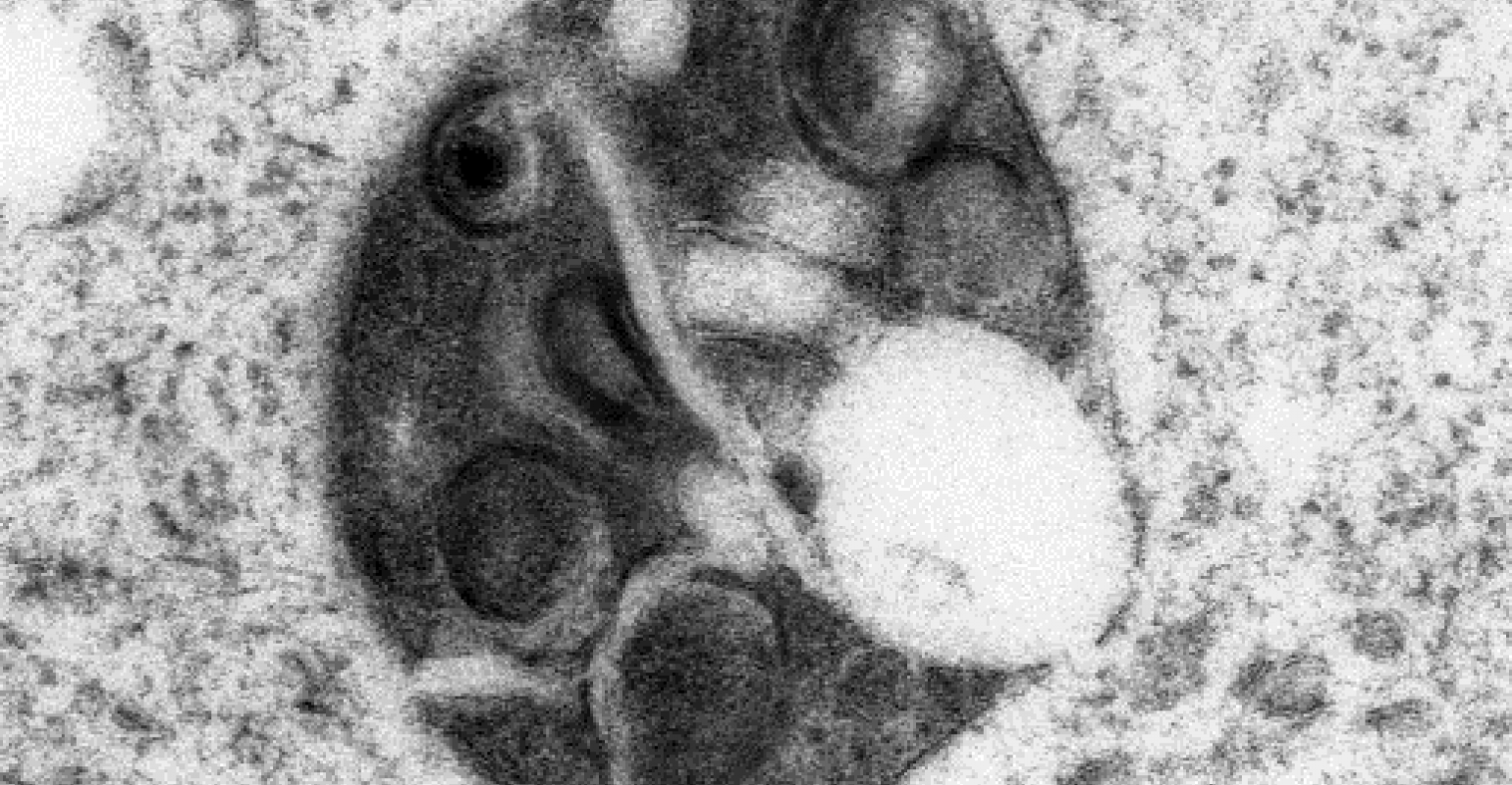 rubella-virus-replication-organelle-high-pressure-freezing-cell